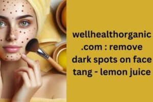 Wellhealthorganic.com Remove Dark Spots on Face Tang Lemon Juice